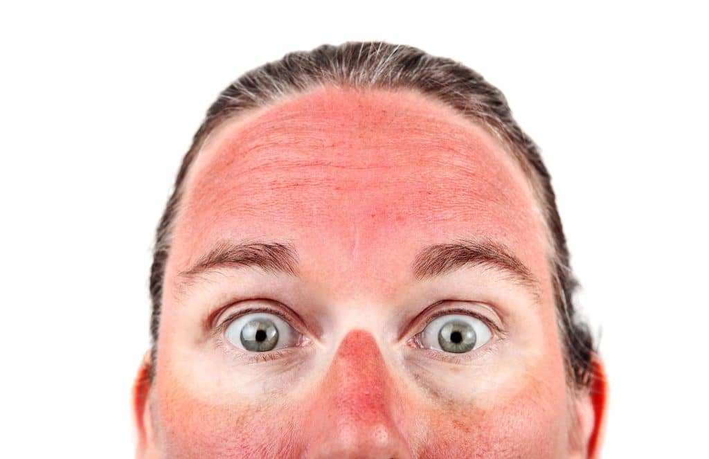 Sun Damaged Skin and Why You Need Checked Immediately | The Dermatology  Center Of Indiana