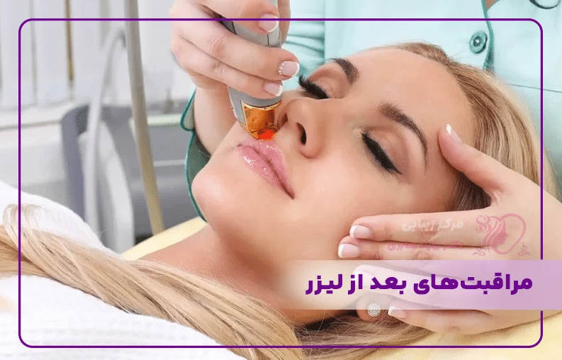 آیا لیزر موهای زائد برای همه مناسب است؟