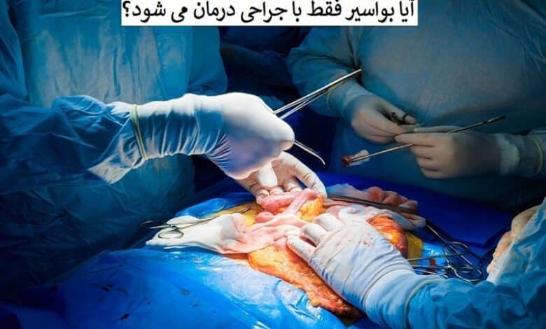 آیا بواسیر حتما به جراحی نیاز دارد