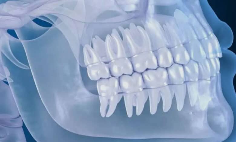 تصویربرداری CBCT قبل از کاشت ایمپلنت