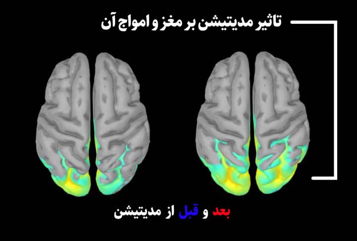 تاثیر مدیتیشن بر امواج مغز و تمرکز ذهنی