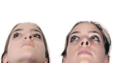 عدم تقارن پره های بینی بعد از جراحی