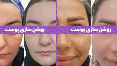 خدمات پوست در کلینیک دسپینا