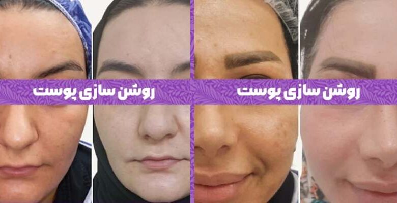 خدمات پوست در کلینیک دسپینا