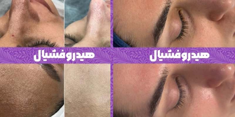 خدمات پوست در کلینیک دسپینا